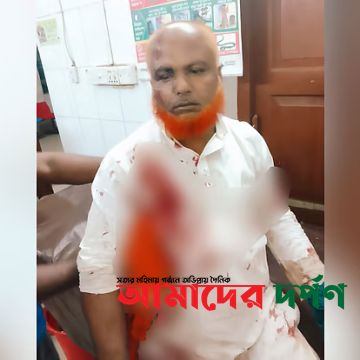 সাতকানিয়ার ধারালো অস্ত্র নিয়ে বিএনপির দুই পক্ষের সংঘর্ষ, ৮ নেতা-কর্মী আহত