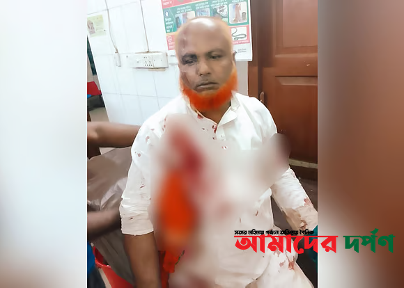 সাতকানিয়ার ধারালো অস্ত্র নিয়ে বিএনপির দুই পক্ষের সংঘর্ষ, ৮ নেতা-কর্মী আহত