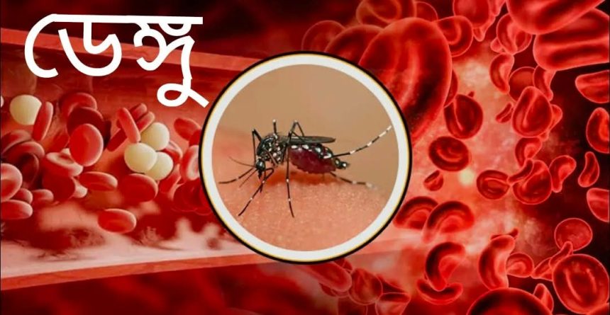 চাঁপাইনবাবগঞ্জে ২৪ ঘণ্টায় নতুন ৫৯ ডেঙ্গু রোগী শনাক্ত, চিকিৎসাধীন ১২৭